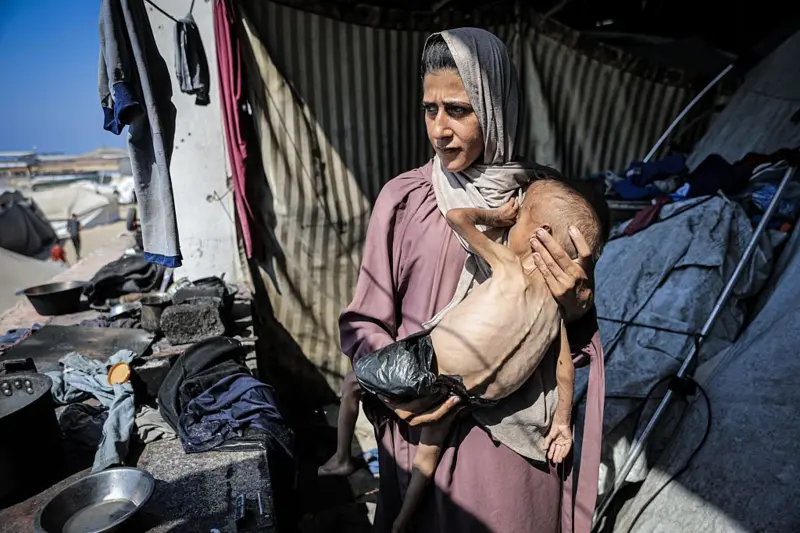 Una madre sosteniendo a su hijo desnutrido en brazos